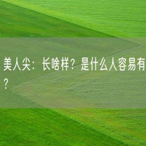 美人尖：长啥样？是什么人容易有？